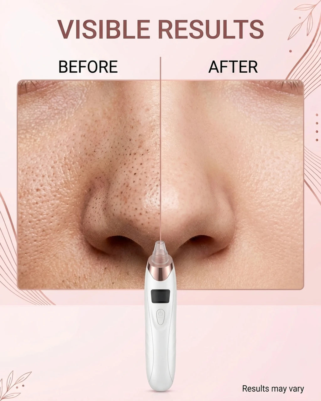 Electric Blackhead Remover Vacuum – Rechargeable Pore Cleaner & Acne Extractor Device